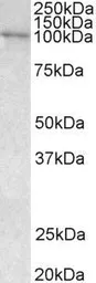 Anti-VAV3 antibody, Internal used in Western Blot (WB). GTX89695