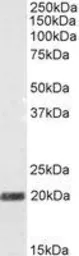 Anti-STMN2 antibody, N-term used in Western Blot (WB). GTX89696