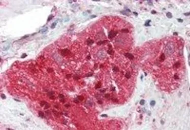 Anti-STMN2 antibody, N-term used in IHC (Paraffin sections) (IHC-P). GTX89696