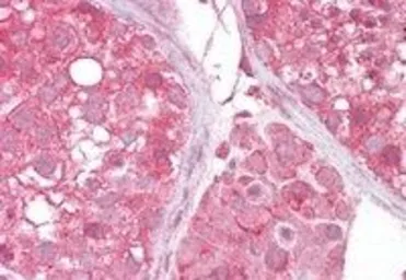 Anti-MCT2 antibody, C-term used in IHC (Paraffin sections) (IHC-P). GTX89697