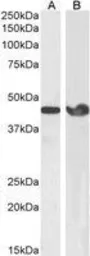 Anti-alpha Smooth Muscle Actin antibody, N-term used in Western Blot (WB). GTX89701