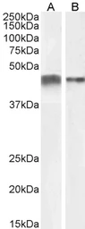 Anti-alpha Smooth Muscle Actin antibody, N-term used in Western Blot (WB). GTX89701