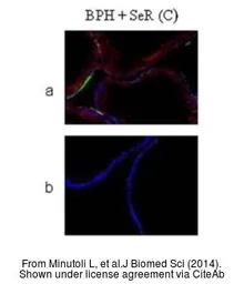 Anti-alpha Smooth Muscle Actin antibody, N-term used in Immunocytochemistry/ Immunofluorescence (ICC/IF). GTX89701