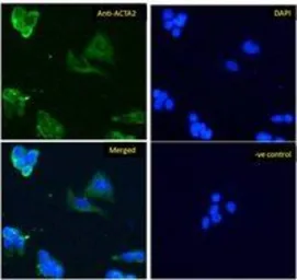 Anti-alpha Smooth Muscle Actin antibody, N-term used in Immunocytochemistry/ Immunofluorescence (ICC/IF). GTX89701