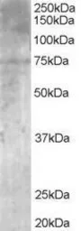 Anti-MPP5 antibody, N-term used in Western Blot (WB). GTX89702