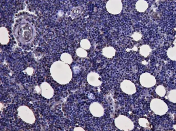 Anti-KLF1 antibody, N-term used in IHC (Paraffin sections) (IHC-P). GTX89710