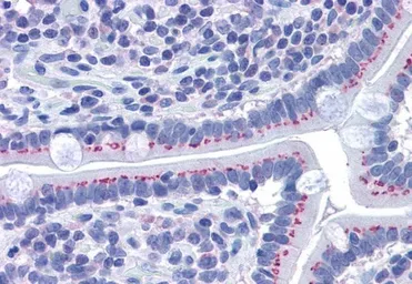 Anti-GOLPH2 antibody, C-term used in IHC (Paraffin sections) (IHC-P). GTX89715