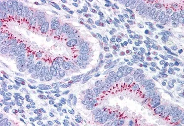 Anti-GOLPH2 antibody, C-term used in IHC (Paraffin sections) (IHC-P). GTX89715