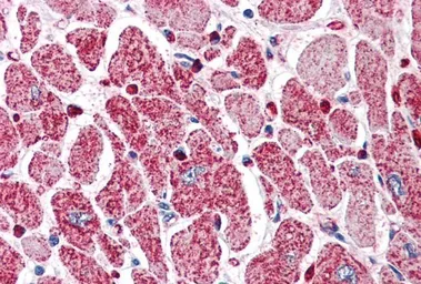 Anti-PI3 kinase C2 alpha antibody, C-term used in IHC (Paraffin sections) (IHC-P). GTX89716