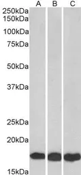 Anti-UBE2L3 antibody, C-term used in Western Blot (WB). GTX89721