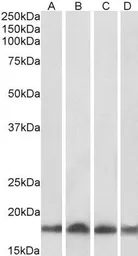 Anti-UBE2L3 antibody, C-term used in Western Blot (WB). GTX89721