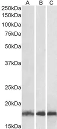 Anti-UBE2L3 antibody, C-term used in Western Blot (WB). GTX89721