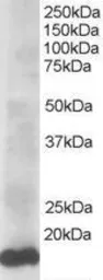 Anti-UBE2L3 antibody, C-term used in Western Blot (WB). GTX89721