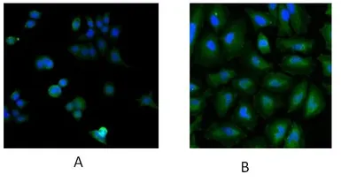 Anti-UBE2L3 antibody, C-term used in Immunocytochemistry/ Immunofluorescence (ICC/IF). GTX89721