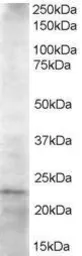 Anti-HIP2 antibody, C-term used in Western Blot (WB). GTX89722
