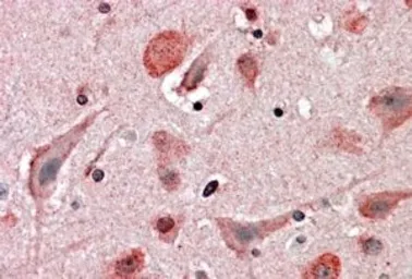 Anti-HIP2 antibody, C-term used in IHC (Paraffin sections) (IHC-P). GTX89722