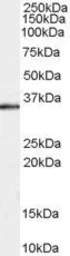 Anti-STUB1 antibody, C-term used in Western Blot (WB). GTX89724