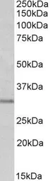 Anti-MSX1 antibody, N-term used in Western Blot (WB). GTX89726