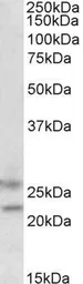 Anti-FBXO44 antibody, C-term used in Western Blot (WB). GTX89727