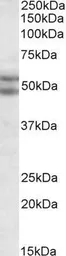 Anti-BAG5 antibody, N-term used in Western Blot (WB). GTX89733