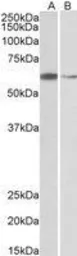Anti-ARIH2 antibody, C-term used in Western Blot (WB). GTX89734