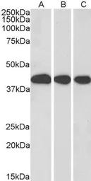 Anti-MRG15 antibody, N-term used in Western Blot (WB). GTX89736