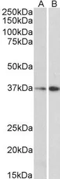Anti-MRG15 antibody, N-term used in Western Blot (WB). GTX89736