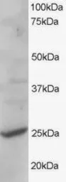 Anti-CYB561D2 antibody, C-term used in Western Blot (WB). GTX89745