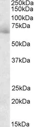 Anti-AKAP10 antibody, C-term used in Western Blot (WB). GTX89747