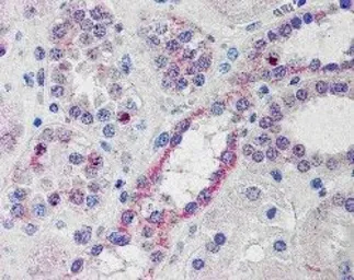 Anti-NOXO1 antibody, C-term used in IHC (Paraffin sections) (IHC-P). GTX89749