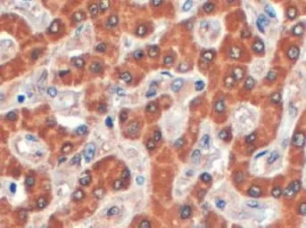 Anti-Syntenin 2 antibody, C-term used in IHC (Paraffin sections) (IHC-P). GTX89753