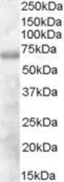 Anti-DEF6 antibody, N-term used in Western Blot (WB). GTX89758