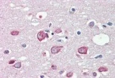 Anti-MLL4 antibody, C-term used in IHC (Paraffin sections) (IHC-P). GTX89763