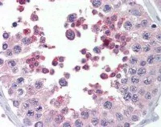 Anti-MLL4 antibody, C-term used in IHC (Paraffin sections) (IHC-P). GTX89763