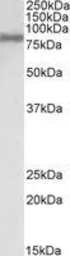 Anti-FACL4 antibody, C-term used in Western Blot (WB). GTX89766