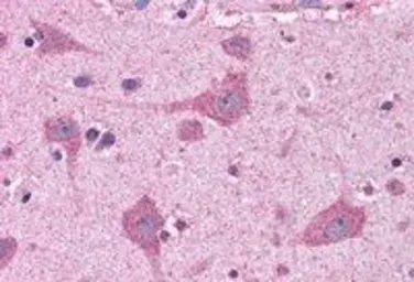 Anti-FACL4 antibody, C-term used in IHC (Paraffin sections) (IHC-P). GTX89766