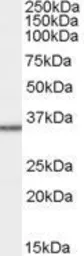 Anti-MRPL3 antibody, C-term used in Western Blot (WB). GTX89768