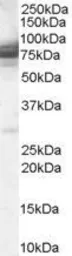 Anti-CMG1 antibody, C-term used in Western Blot (WB). GTX89771