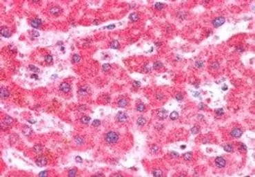 Anti-CMG1 antibody, C-term used in IHC (Paraffin sections) (IHC-P). GTX89771
