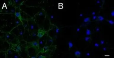 Anti-CMG1 antibody, C-term used in Immunocytochemistry/ Immunofluorescence (ICC/IF). GTX89771