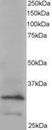Anti-ARPC2 antibody, C-term used in Western Blot (WB). GTX89775