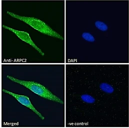 Anti-ARPC2 antibody, C-term used in Immunocytochemistry/ Immunofluorescence (ICC/IF). GTX89775