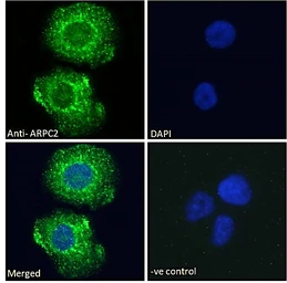 Anti-ARPC2 antibody, C-term used in Immunocytochemistry/ Immunofluorescence (ICC/IF). GTX89775