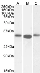 Anti-ARPC2 antibody, C-term used in Western Blot (WB). GTX89775