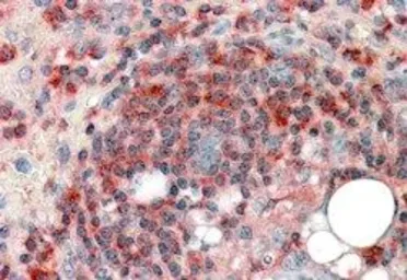 Anti-ARPC2 antibody, C-term used in IHC (Paraffin sections) (IHC-P). GTX89775
