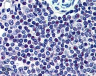 Anti-HMG20A antibody, C-term used in IHC (Paraffin sections) (IHC-P). GTX89778