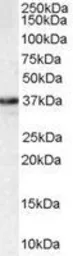 Anti-MPG antibody, C-term used in Western Blot (WB). GTX89783