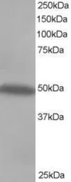 Anti-CSK antibody, C-term used in Western Blot (WB). GTX89784