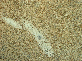 Anti-Iba1 (isoform 1 and 3) antibody, C-term used in IHC (Paraffin sections) (IHC-P). GTX89792