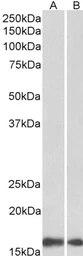 Anti-Iba1 (isoform 1 and 3) antibody, C-term used in Western Blot (WB). GTX89792